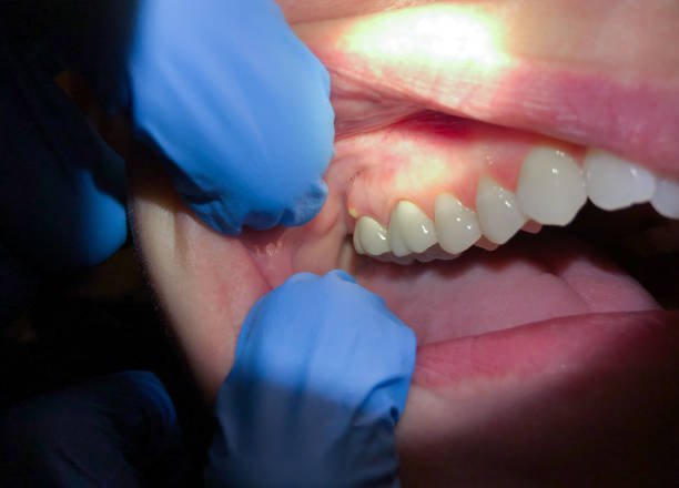 Best Cosmetic Emergency Dentistry in Georgetown, IL