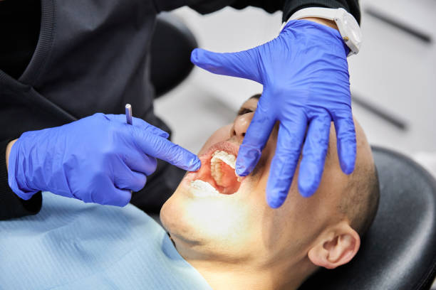 Best Emergency Dental Care for Broken or Chipped Teeth in Georgetown, IL